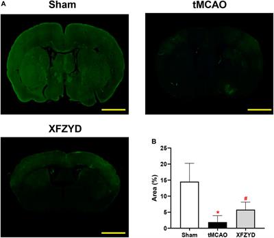 The mechanisms underlying the actions of Xuefu Zhuyu decoction pretreatment against neurological deficits after ischemic stroke in mice: The mediation of glymphatic function by aquaporin-4 and its anchoring proteins